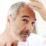 Anti-Aging: Hilfe bei Haarausfall